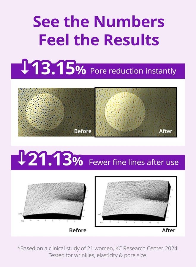 SNP 10,000ppm Deep Collagen + PDRN + Retinol Hydrogel Mask | 8 Layer 125Da Collagen Face Mask | Overnight Facial Mask | Patent Skin Hydration | Hydrating Facial Mask | Face Mask Skin Care | 4 Sheets - Image 4